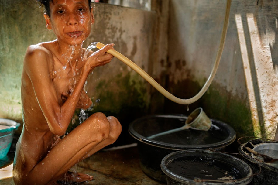 Foto Scioccanti Dei Malati Mentali In Indonesia Che Vivono In Condizioni Disumane