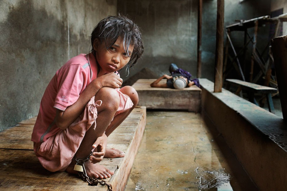 Foto Scioccanti Dei Malati Mentali In Indonesia Che Vivono In Condizioni Disumane