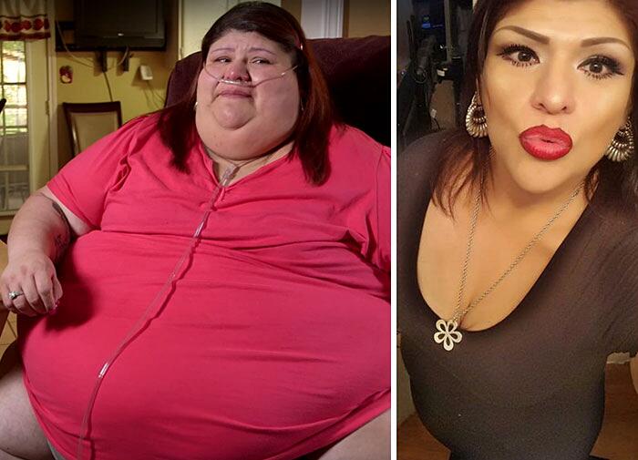 Le Persone Piu Grasse.25 Trasformazioni Incredibili Di Persone Obese Che Hanno Perso Peso Keblog